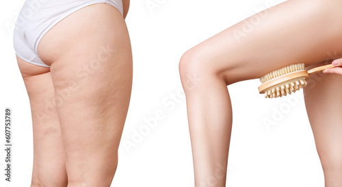 Collage of woman hips before and after exfoliating brush.