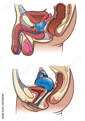 Diagram of a cross section of the human reproductive system in vector
