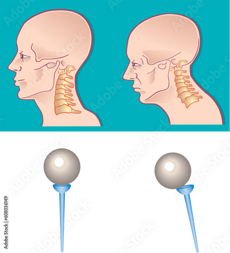 Illustration of neck spine cross section
