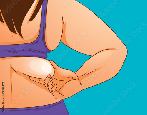 A woman's body with problem areas. Back fat. Bra bulge. Medical infographic. Healthcare illustration. Vector illustration. 