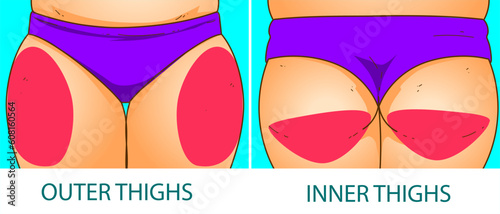 A woman's body with problem areas. Medical infographic. Healthcare illustration. Vector illustration. 