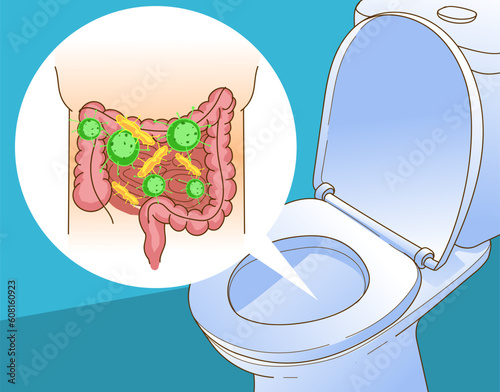 Dairea. Stool chart. Bacteria in the gut. Health problems. Medical illustration. Vector illustration.