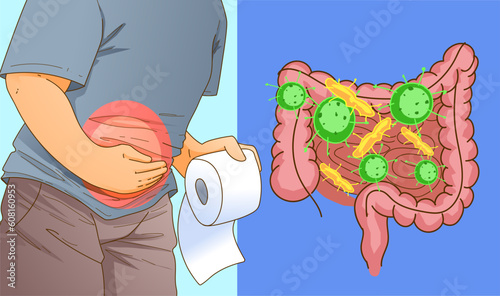 Dairea. Stool chart. Bacteria in the gut. Health problems. Medical illustration. Vector illustration.