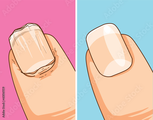 Burrs. Burrs danger. Damaged skin. Bleeding wound.  Healthcare illustration, vector illustration. 