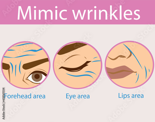 A woman faced age problems. Age skin. Wrinkles on the forehead.  Mimic wrinkles. Healthcare illustration. Vector illustration.