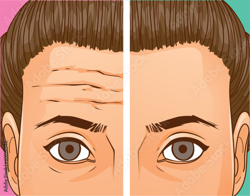 A woman faced age problems. Age skin. Wrinkles on the forehead.  Mimic wrinkles. Healthcare illustration. Vector illustration.
