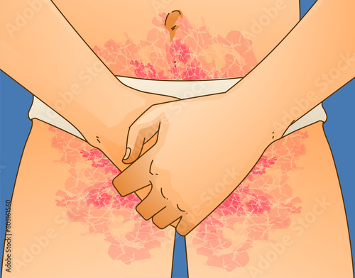 The human body with skin disease. Healthcare illustration. Vector illustration.  photo