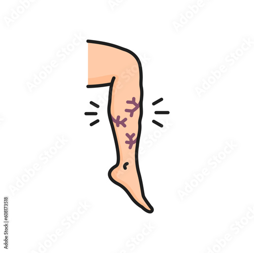 Varicose vein, venous edema, hypoproteinemia treatment disease isolated color line icon. Vector venous disease leg swelling, vascular mesh on legs