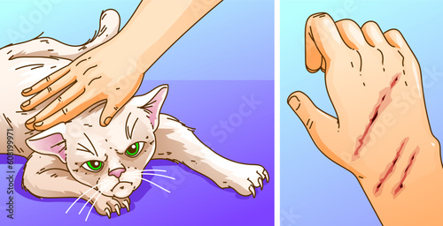 Human caresses cat. Cat scratched a human. Scratches on the skin. Healthcare illustration. Vector illustration.