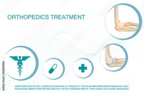 Technology for treatment of wrist elbow and arm joint bone injury. Abstract traumatology and orthopedics. Medical science in the hospital for body joints.