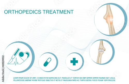 Technology for treatment of wrist elbow and arm joint bone injury. Abstract traumatology and orthopedics. Medical science in the hospital for body joints.