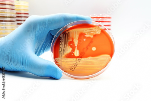 Microbiology. A Petri plate of Methicillin-resistant Staphylococci MRSA bacteria, a Superbug  photo