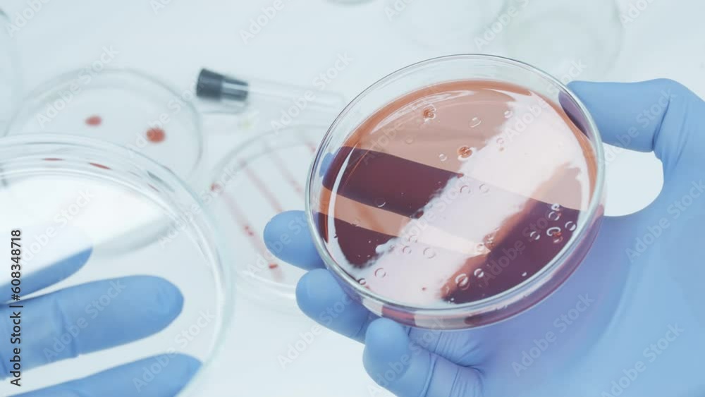 Bacteria and microbial cultures growth on a petri dish in microbiology
