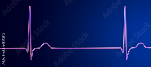 Electrocardiogram ECG displaying a junctional rhythm, 3D illustration