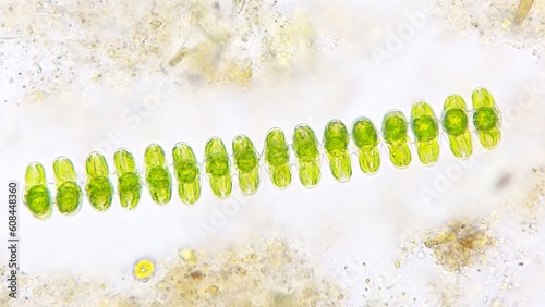 Spondylosium javanicum, a species of filamentous green algae that produce exopolysaccharide. Stacked photo photo