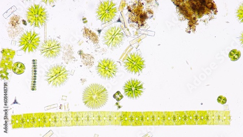 Phytoplankton (Micrasterias, staurastrum, Spondylosium, Staurodesmus, diatom, etc) blooming under microscope. 200x magnification. Selective focus photo