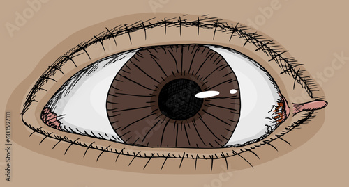 Close up view of human eye with skin tag in corner