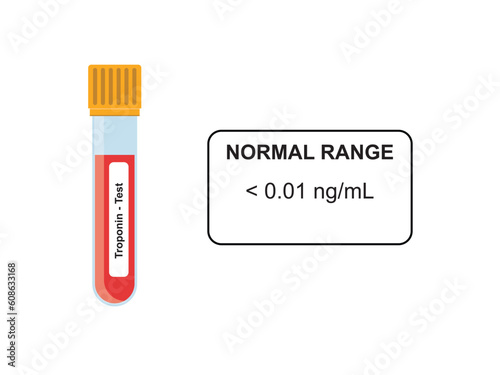 Troponin Blood Test Concept Design. Vector Illustration.