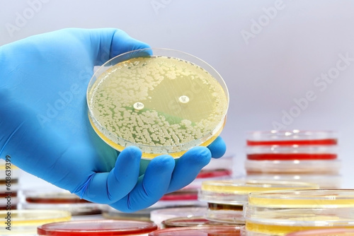 The rise of antibiotic-resistant bacterial infections. Super bugs. A microbiological culture Petri dish with bacteria and an antibiotic resistance test