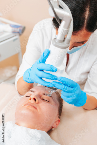 Laser skin resurfacing procedure - deep peeling, in which the top layer of skin is removed with a laser