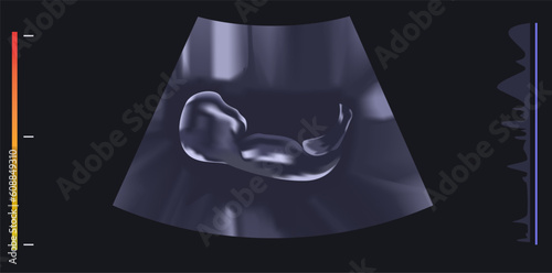Ultrasound vector illustration. Expecting a baby and ultrasonography image. 