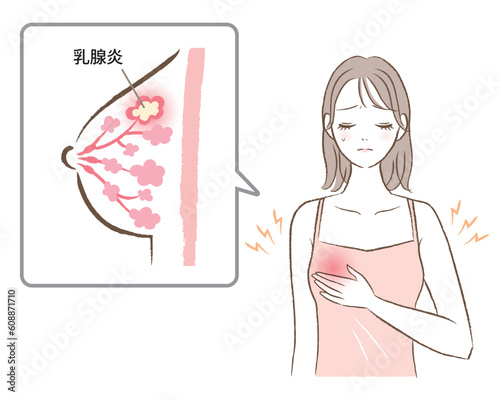 乳腺炎で胸が痛む女性のイラスト