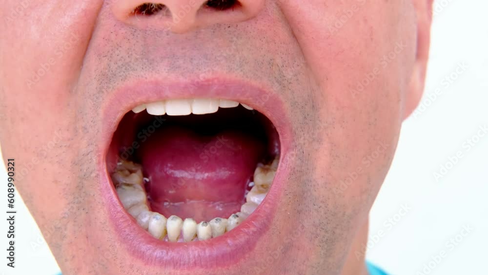 dental prosthetist examines oral cavity patient, charismatic mature man
