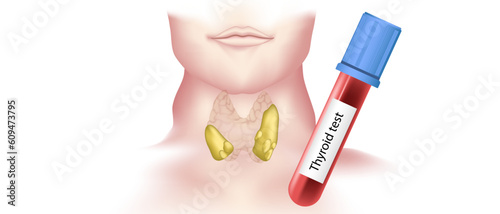hypothyroidism vs hyperthyroidism. healthy and unhealthy thyroid test. Thyroid tumour and inflammation treatment. Parathyroid glands. neck pain and sore. Throat cancer and esophagus. Goitre problem. 