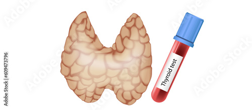 hypothyroidism vs hyperthyroidism. healthy and unhealthy thyroid test. Thyroid tumour and inflammation treatment. Parathyroid glands. neck pain and sore. Throat cancer and esophagus. Goitre problem. 