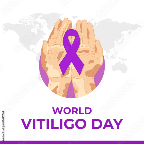 World Vitiligo Day is observed every year on June 25. Suitable for poster, banner, card, social media post, etc