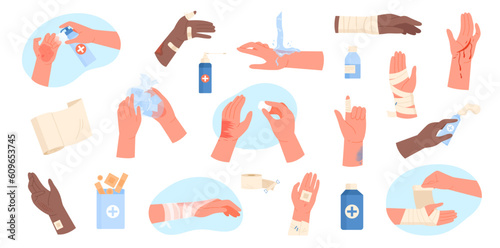 Injured hands set vector illustration. Cartoon isolated human arms with wounds and burn on body skin, cleaning and dressing with bandages, applying medical treatment for injury, first aid for trauma