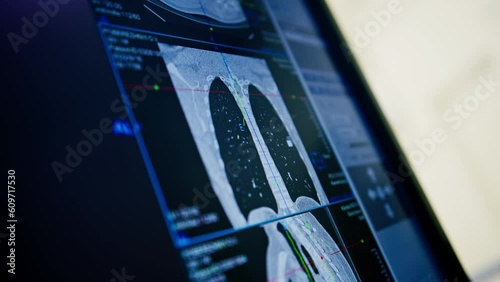 the patient undergoes computer tomography in the clinic, the radiologist monitors the progress of the procedure and the results of the lung scan