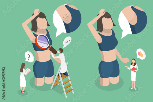 3D Isometric Flat Vector Conceptual Illustration of Epilation Procedure, Armpit Hair Care