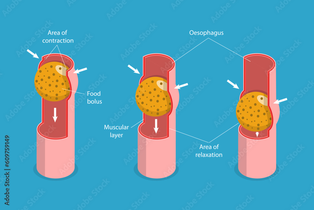 3D Isometric Flat Vector Conceptual Illustration of Peristalsis, Swallow Eating Problem - obrazy, fototapety, plakaty 