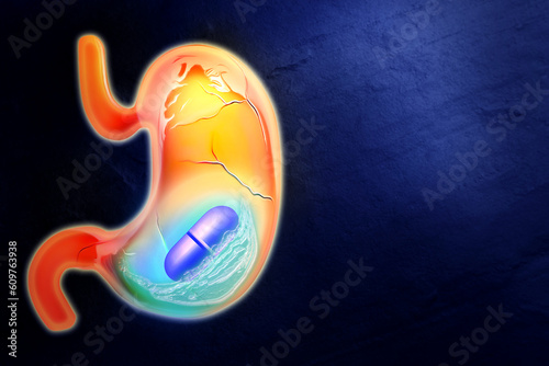 Heartburn treatment. Illustration of unhealthy stomach with antacid pill on dark blue background, space for text. Water symbolizing result of treatment photo