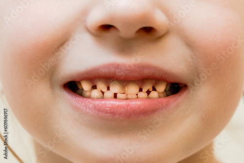 Close up view on of child milk teeth