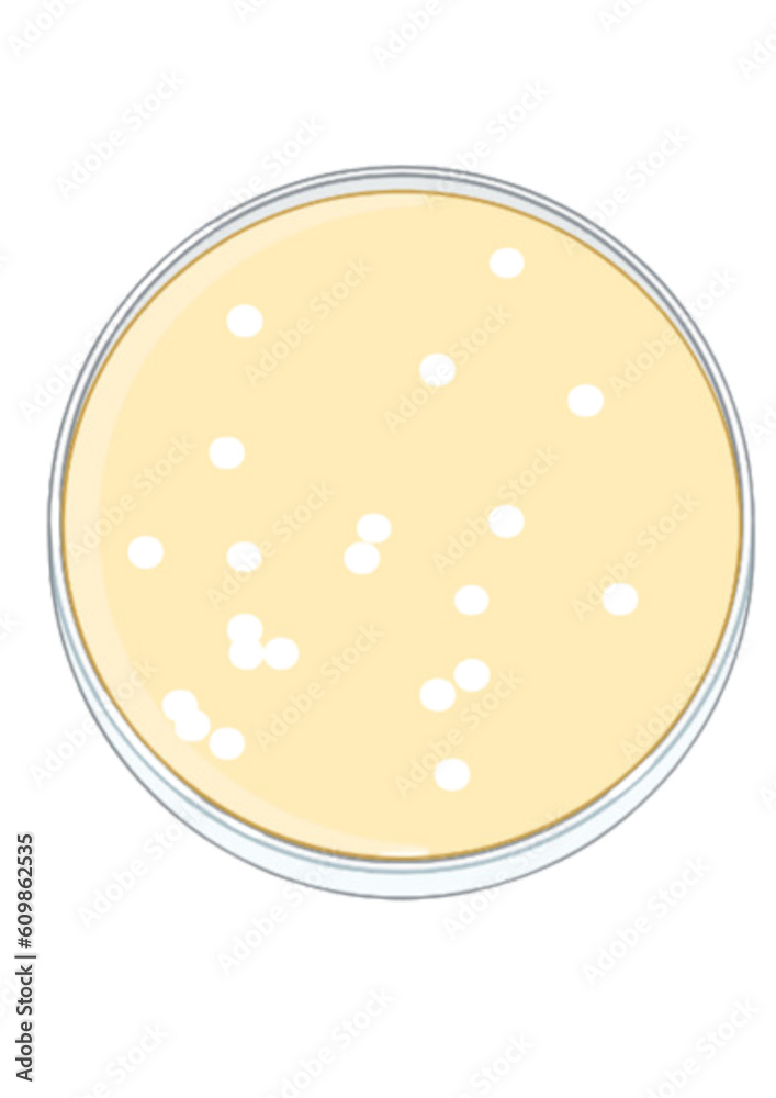 Petri plates with bacteriophage - Plaque assay Petri plates with bacteriophage - Plaque assay
