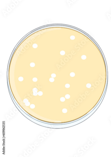 Petri plates with bacteriophage - Plaque assay