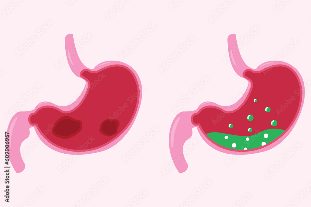 Stomach icon set, stomach problem. vector eps 10 Stomach icon set, stomach problem. vector eps 10