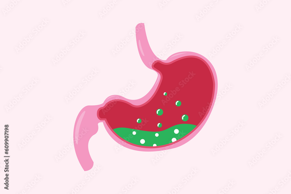 Fototapeta premium Stomach with gas and gastric acid, Transparent ball inside stomach. Isolated on white background. 
