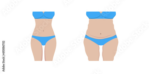 Obraz na płótnie Vector illustration of a fat and thin female body. Isolated white background. Female body before and after weight loss. Flat style. Girl's stomach and breasts after weight loss w salonie