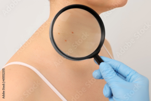 Dermatologist examining patient's birthmark with magnifying glass on beige background, closeup