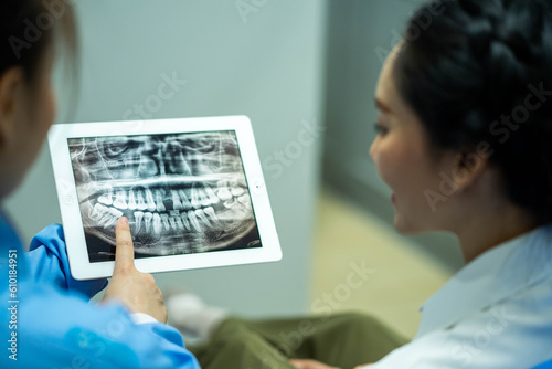 female dentist shows the patient his x-ray, the x-ray is explains the procedure and treatment he will receive on her teeth, the x-ray shows the damage to the teeth.