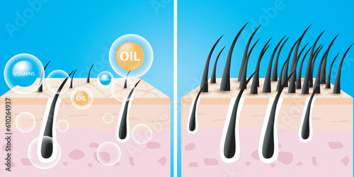Hair care serum follicle diagnostics. Anatomy skin, medical human, epidermis layer, vector illustration design.