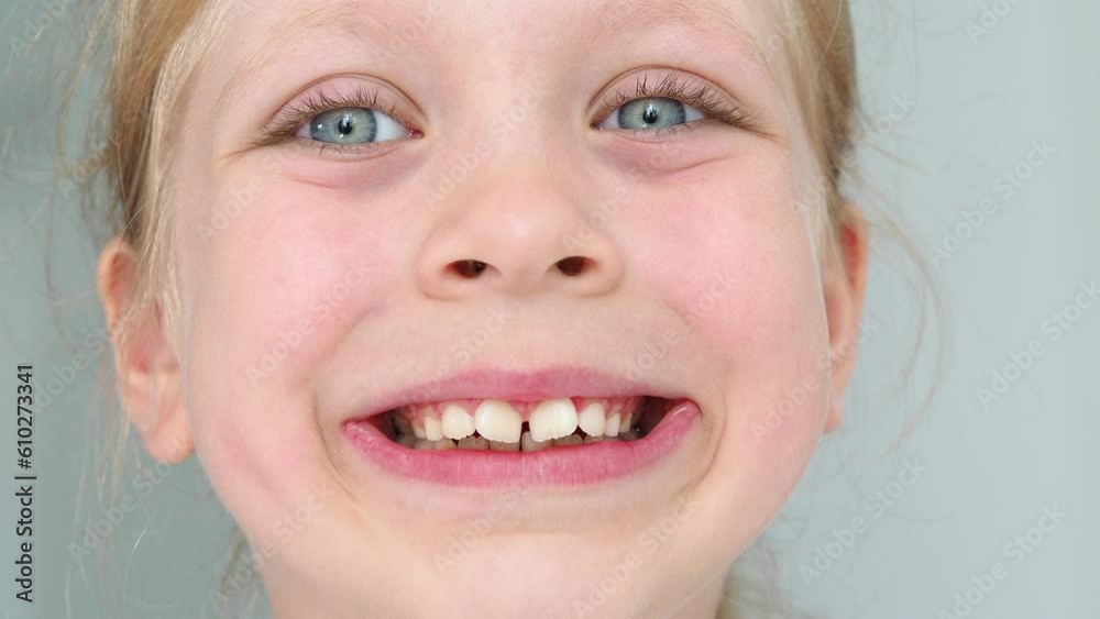 Children's dentistry. The smile of the girl is large. Child's molars. Dentistry and malocclusion. teeth large Children's dentistry. The smile of the girl is large. Child's molars. Dentistry and malocclusion. teeth large