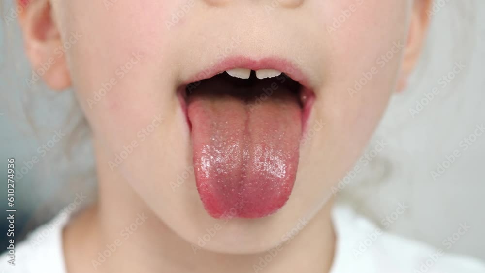 Protruding tongue of a child. macro language. Taste buds on the tongue. The baby opened its