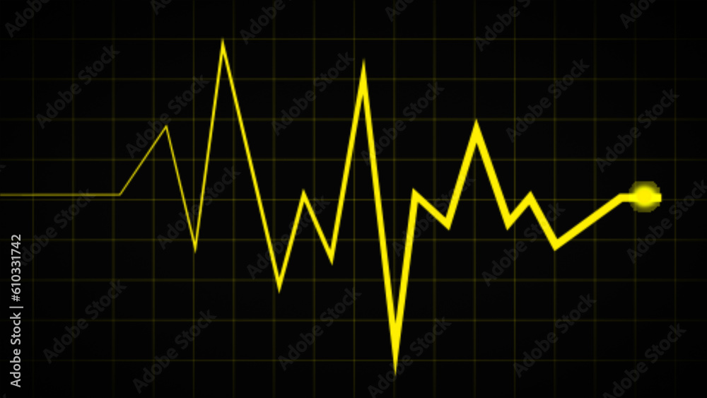 fast-slow-irregular-heartbeat-heartrate-waves-ecg-sinus-rhythm-vector