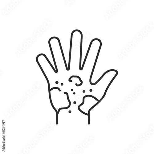 Dermatitis icon. Vector illustration isolated on white. Editable stroke.