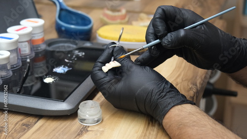 Lab-made teeth whitening. Teeth whitening in the lab