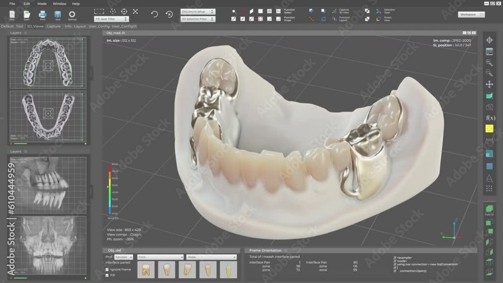 Tooth And Computer Modern computer program creates a digital projection of artificial ...